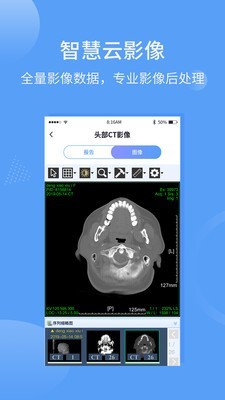指云端医疗